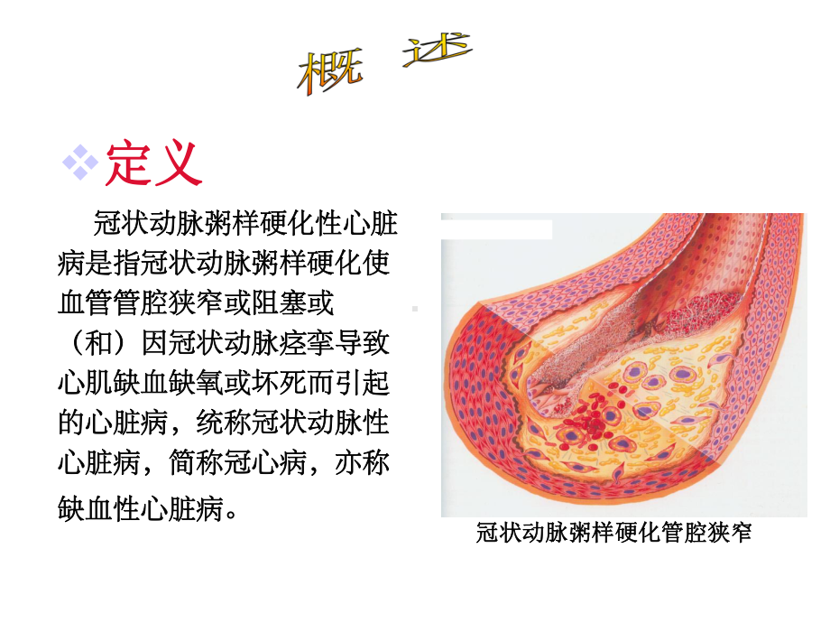 冠状动脉粥样硬化性心脏病人的护理课件.ppt_第3页