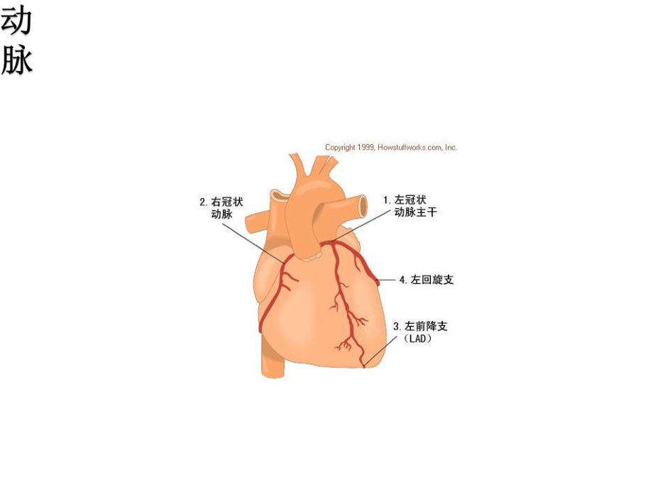 冠心病的典型心电图表现课件.ppt_第3页