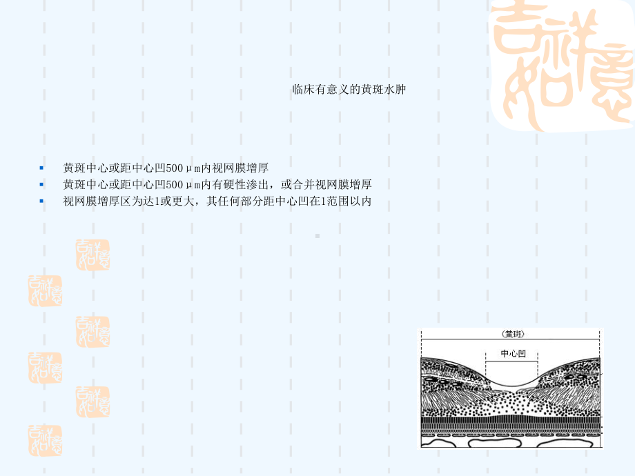 糖尿病性黄斑水肿课件.ppt_第2页