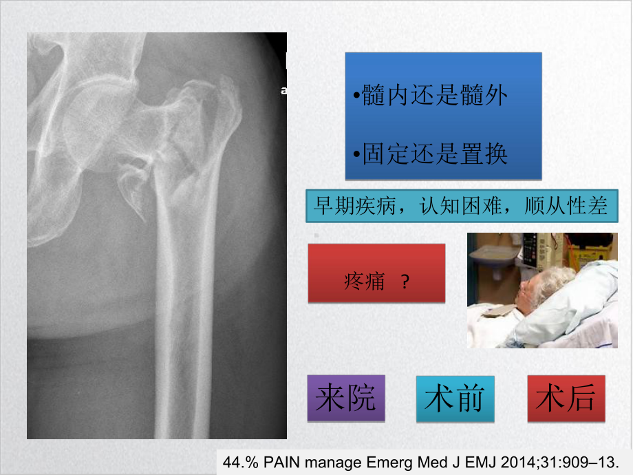 老年髋部骨折手术外的事培训课件.ppt_第3页