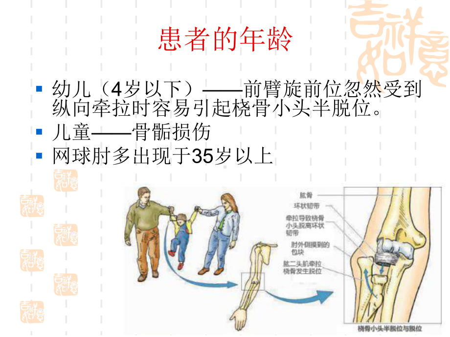 肘关节病史和视诊课件.pptx_第3页