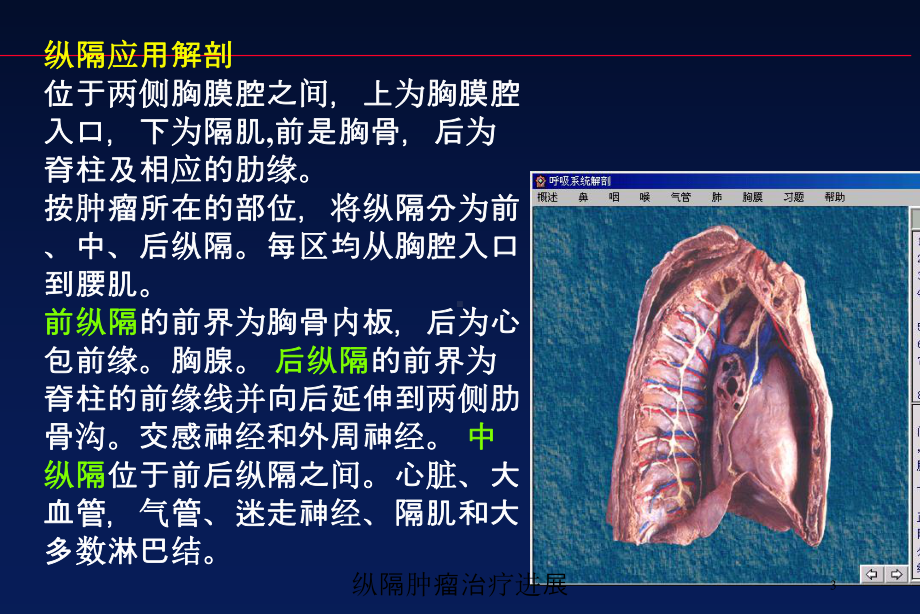 纵隔肿瘤治疗进展培训课件.ppt_第3页