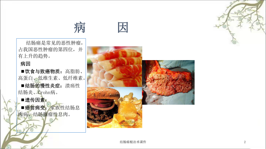 结肠癌根治术课件.ppt_第2页