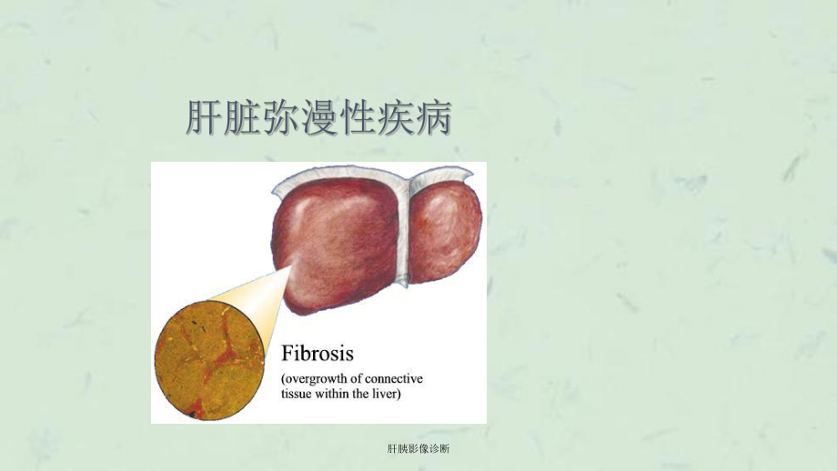 肝胰影像诊断课件.ppt_第1页