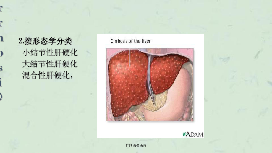 肝胰影像诊断课件.ppt_第3页