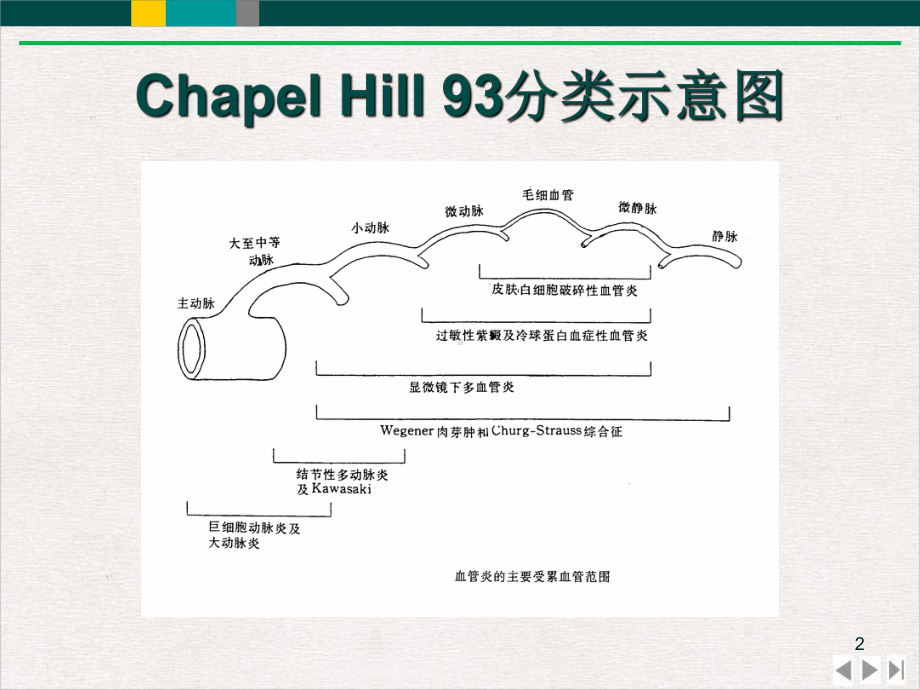 结节性多动脉炎课件.pptx_第2页