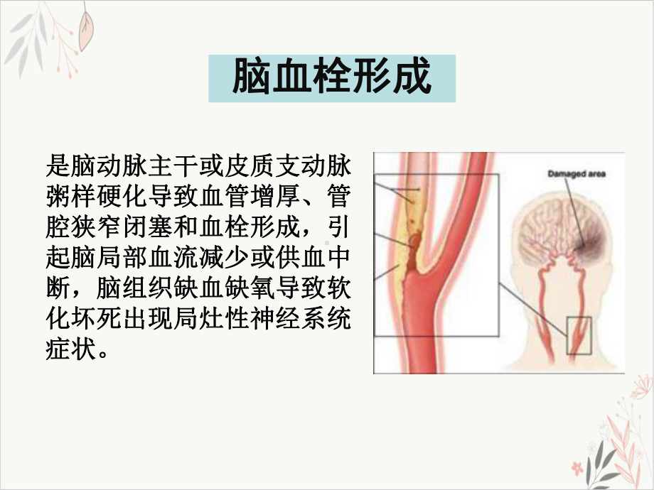 神经病学脑血管病课件1.pptx_第1页