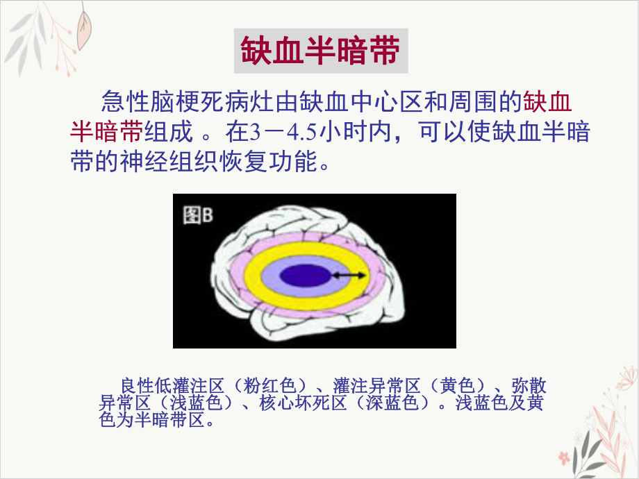 神经病学脑血管病课件1.pptx_第3页