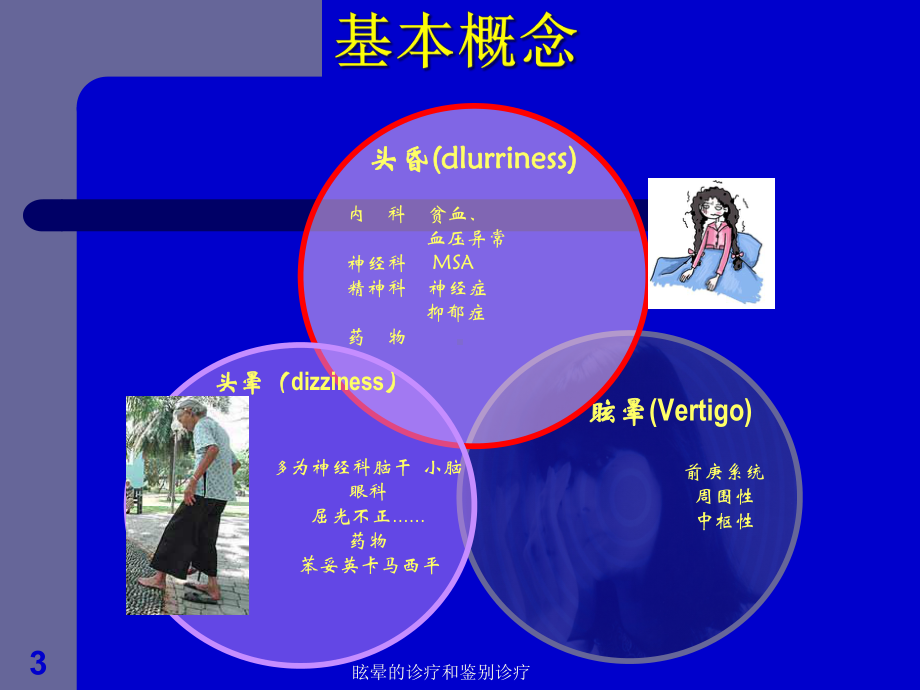 眩晕的诊疗和鉴别诊疗培训课件.ppt_第3页