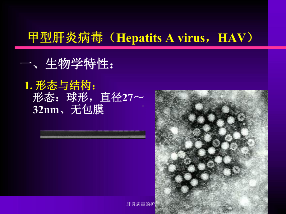 肝炎病毒的护理培训课件.ppt_第3页