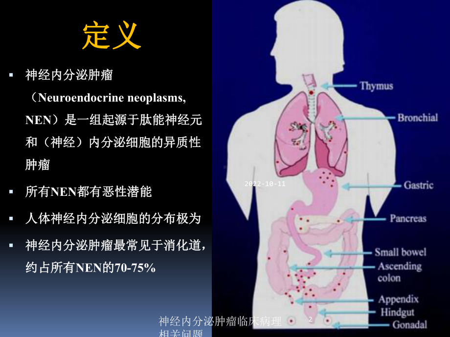 神经内分泌肿瘤临床病理相关问题培训课件.ppt_第2页