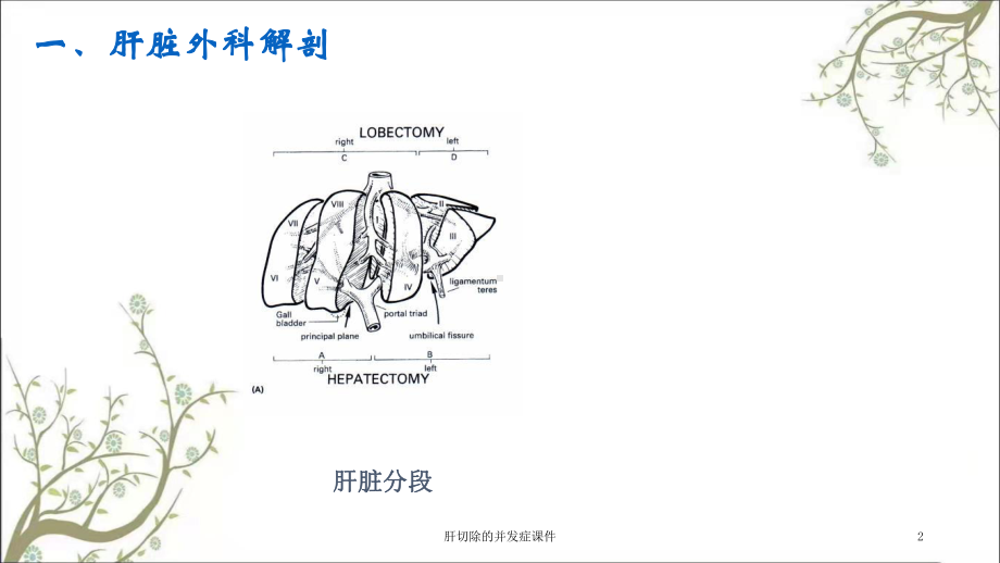 肝切除的并发症课件.ppt_第2页