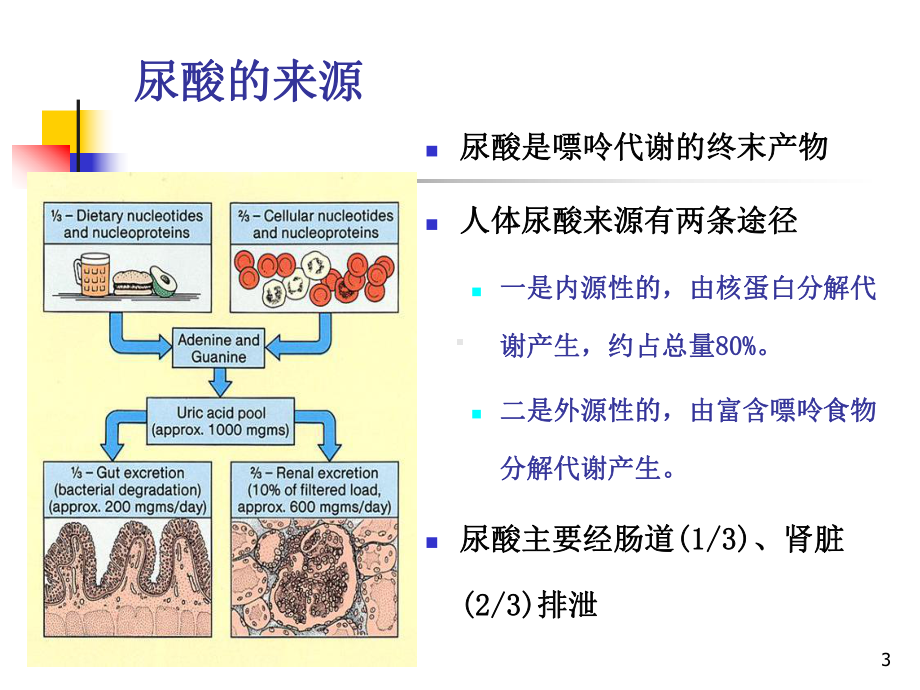 痛风性肾病护理查房参考课件.ppt_第3页