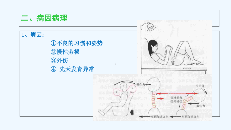 百病之源颈椎病课件.ppt_第3页