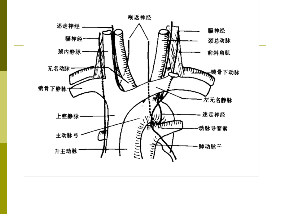 纵隔大血管断层解剖影像课件.ppt_第3页