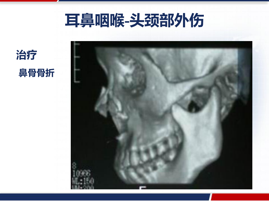 耳鼻咽喉头颈外科学鼻部疾病-课件.pptx_第2页