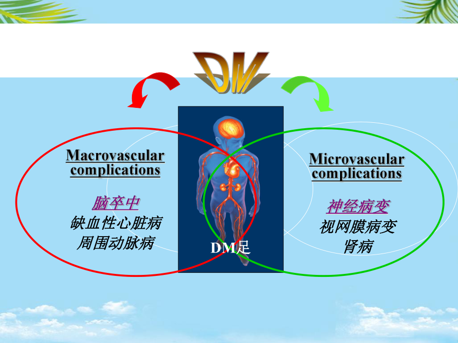 糖尿病微血管并发症的危害课件.ppt_第2页