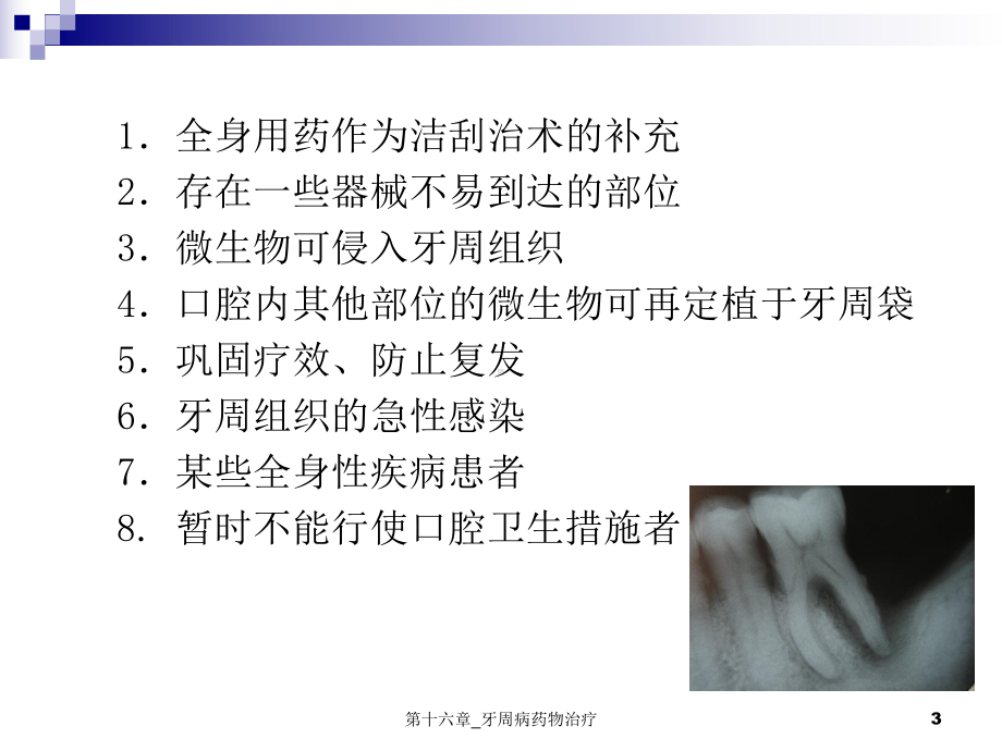 十六章-牙周病药物治疗课件.ppt_第3页