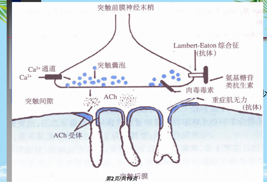 神经病学教学重症肌无力中文全面版课件.pptx_第2页