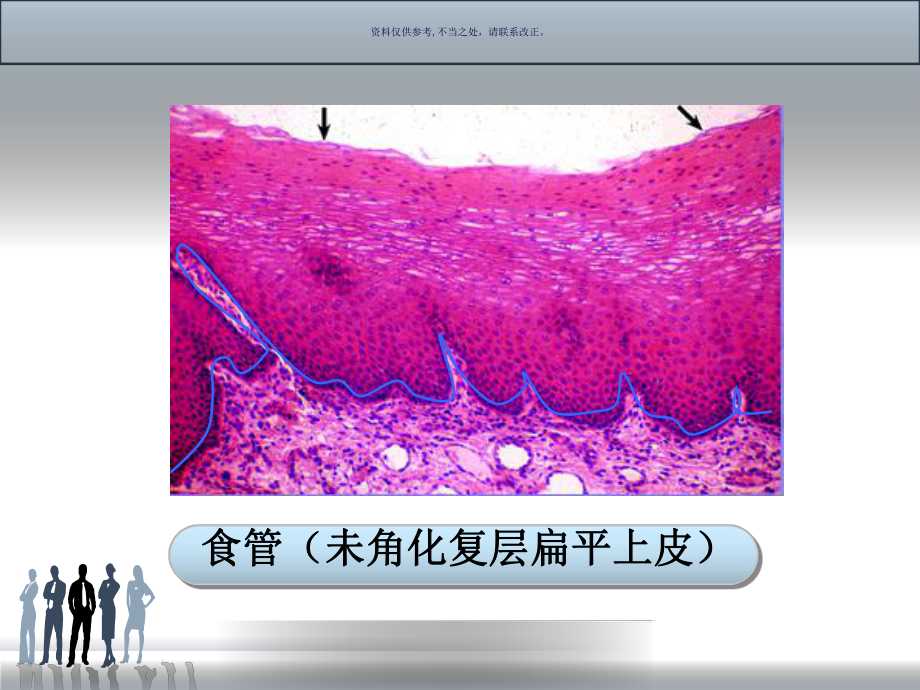 结缔组织医学宣教课件.ppt_第2页