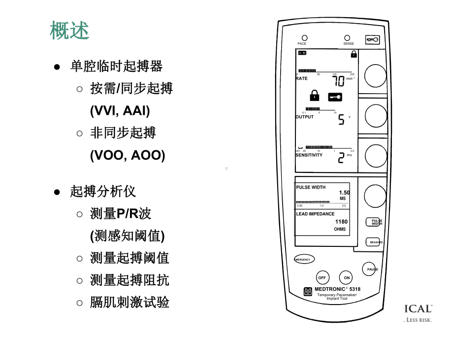 5318型临时起搏器和起搏分析仪解析课件.ppt_第3页