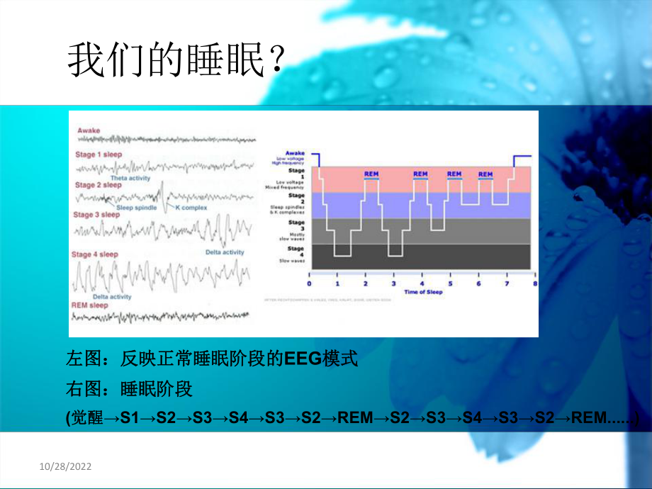 《睡眠障碍1》课件.ppt_第2页