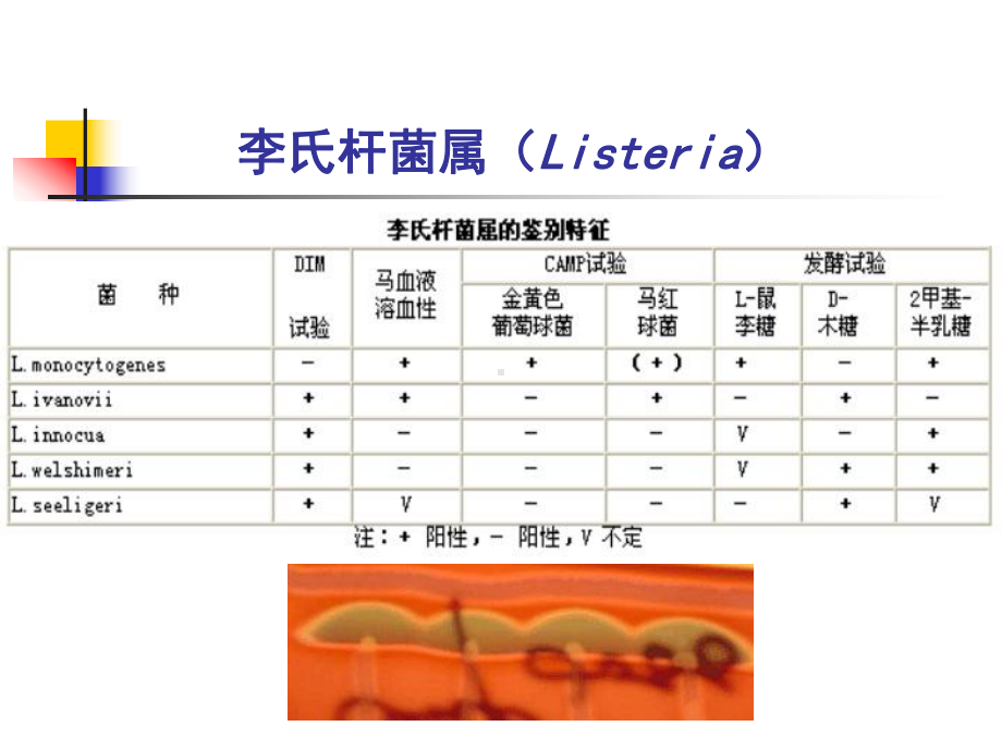 第5章-致病菌的检验7-革兰氏阳性无芽孢杆菌剖析课件.ppt_第3页