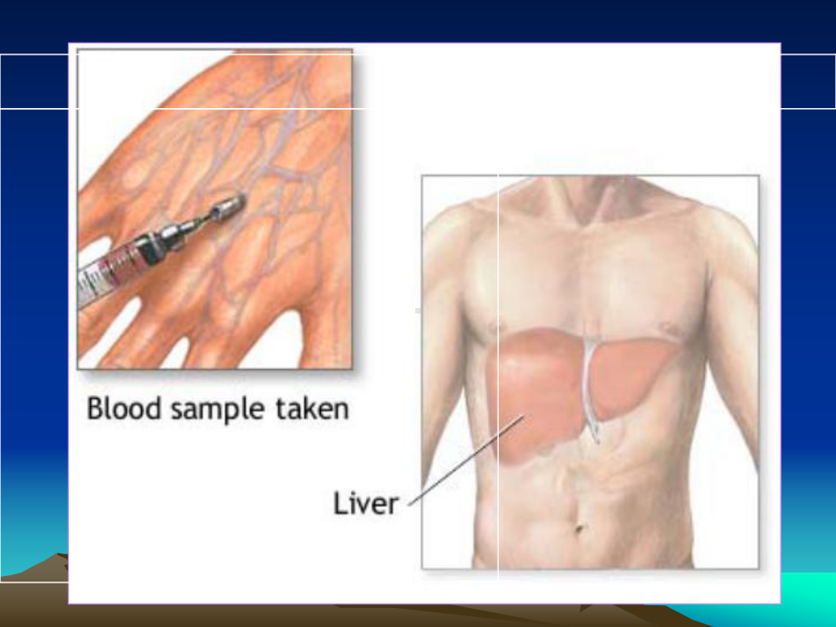 肝脏常用实验室检测最全课件.ppt_第3页