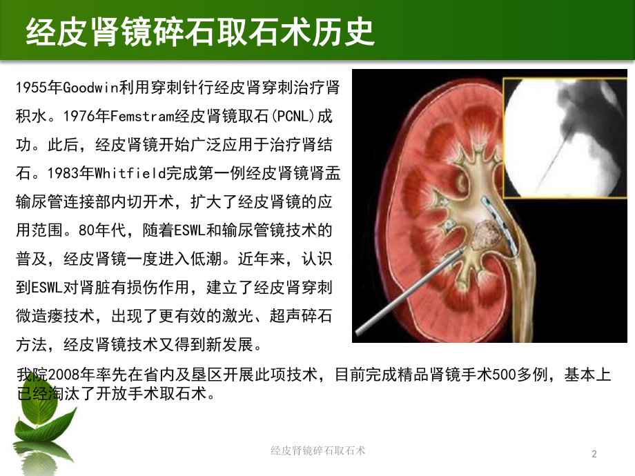 经皮肾镜碎石取石术培训课件.ppt_第2页