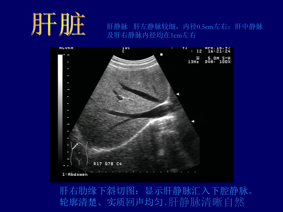 B超影像图谱课件.ppt_第2页