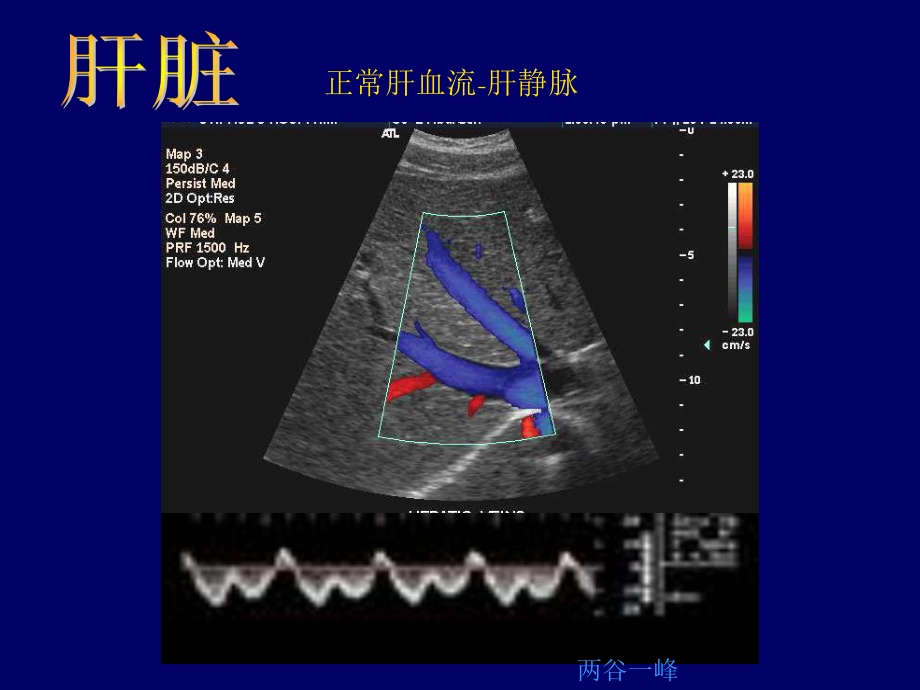 B超影像图谱课件.ppt_第3页