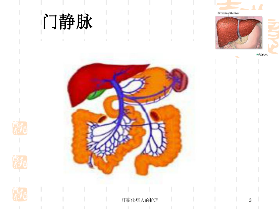 肝硬化病人的护理培训课件.ppt_第3页