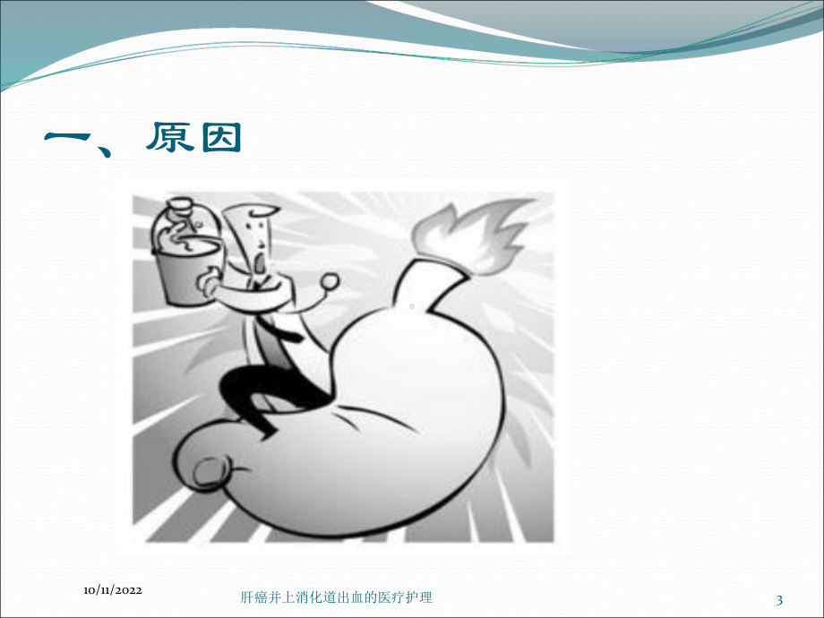 肝癌并上消化道出血的医疗护理培训课件.ppt_第3页