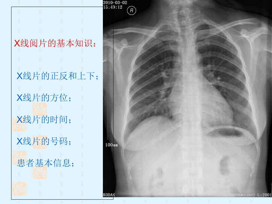 A影像解剖学概论及骨X线解剖概论影像学课件.ppt_第1页