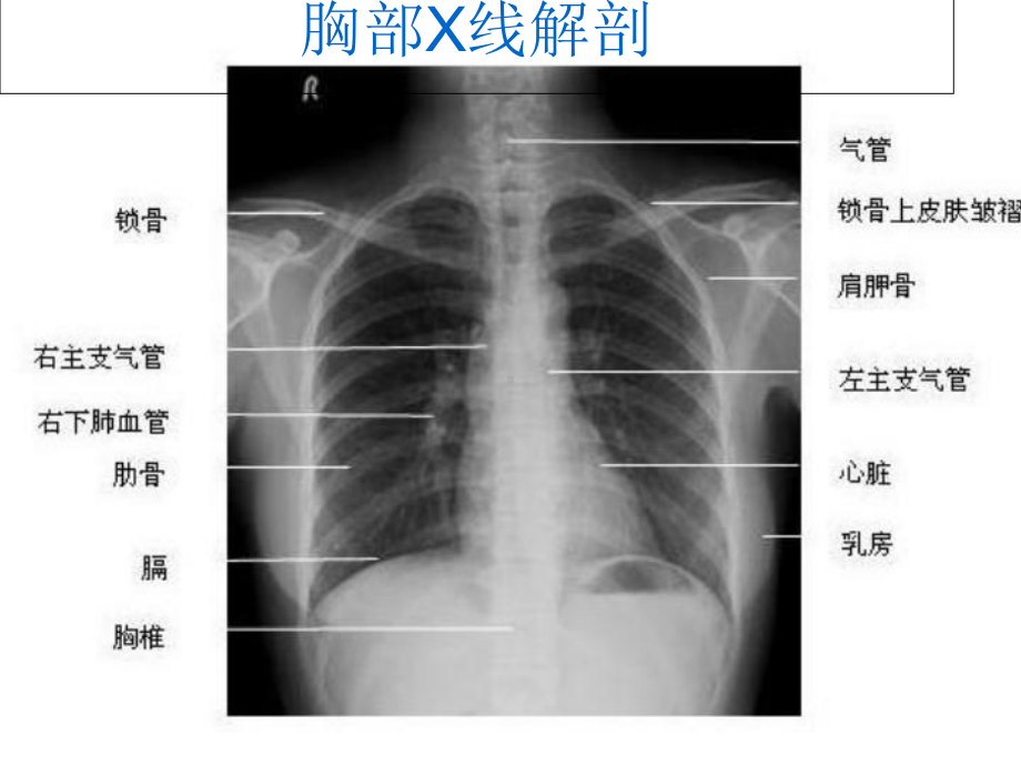 A影像解剖学概论及骨X线解剖概论影像学课件.ppt_第2页