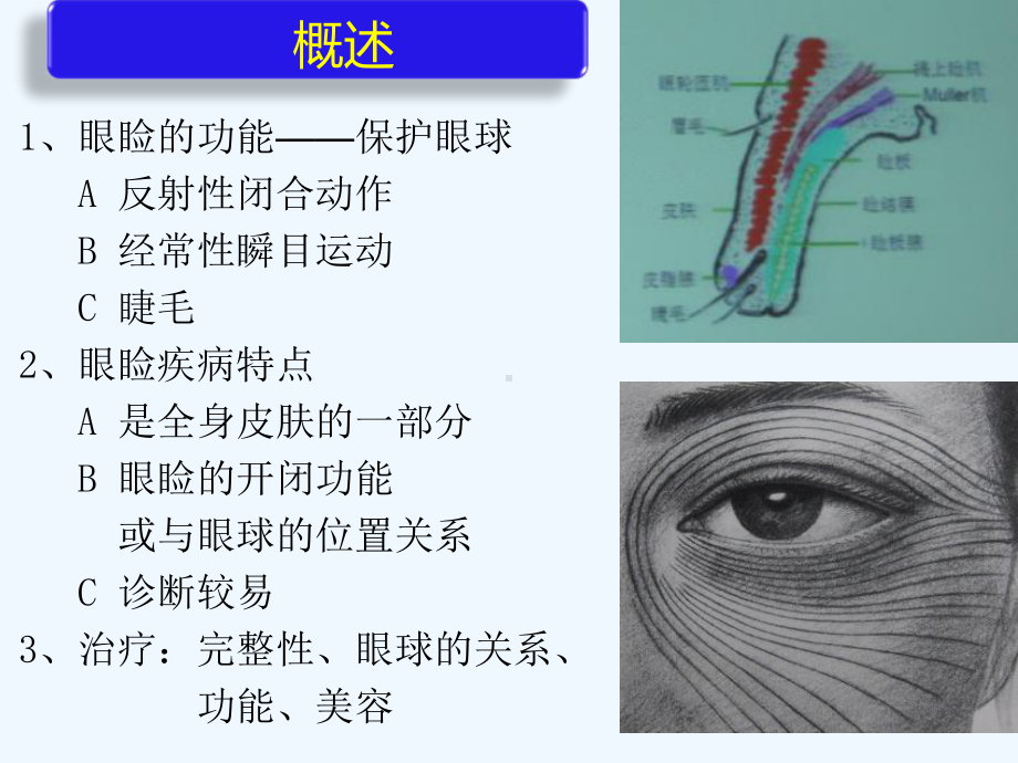 三四章眼睑泪器病课件.ppt_第3页