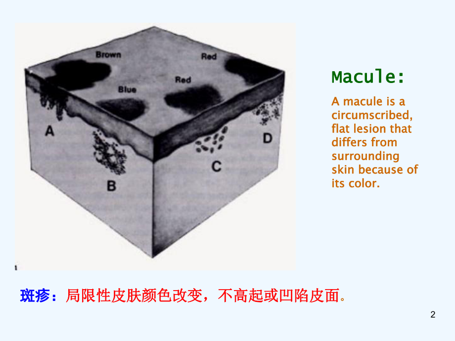 皮肤科基础皮损描述课件.ppt_第2页