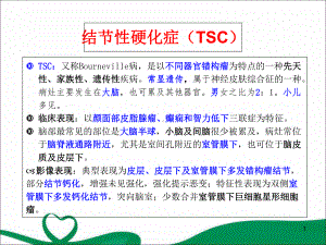 结节性硬化症优质课件.ppt