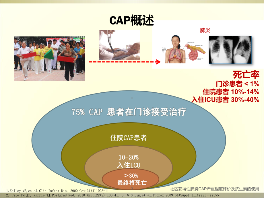 社区获得性肺炎CAP严重程度评价及抗生素的使用培训课件.ppt_第2页