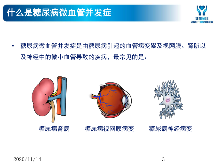 糖尿病专题之微血管并发症课件.ppt_第3页