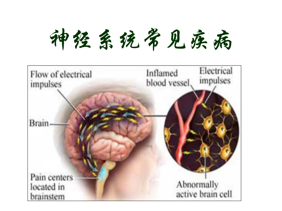 神经系统常见疾病12课件.pptx_第1页