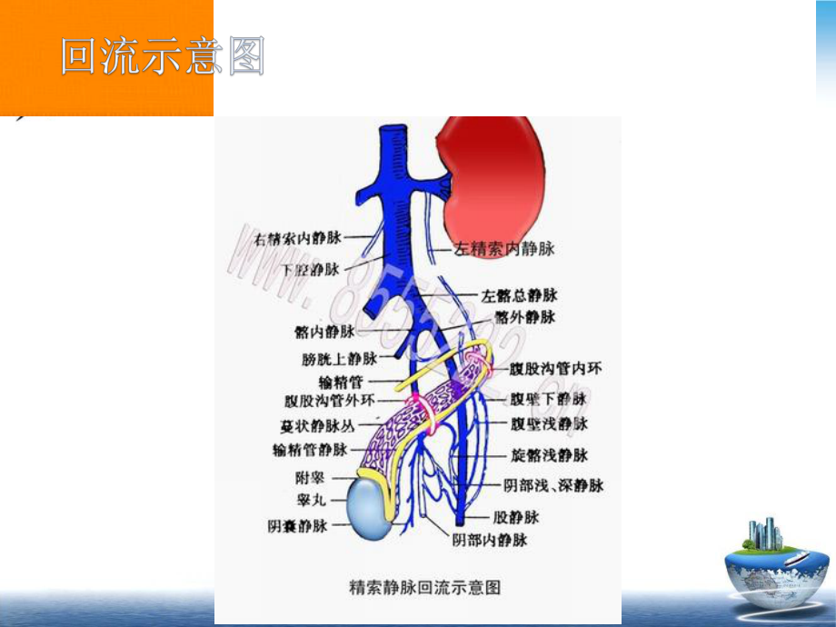 精索静脉曲张及胡桃夹综合征课件.pptx_第3页