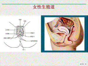 盆腔炎讲解精选课件.pptx