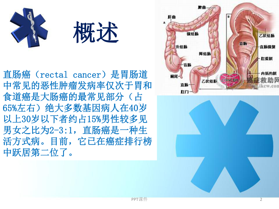 (消化内科)直肠癌护理查房-课件.ppt_第2页