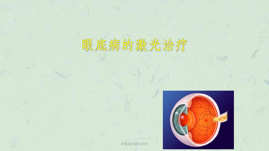 眼底病的激光治疗课件.ppt_第1页