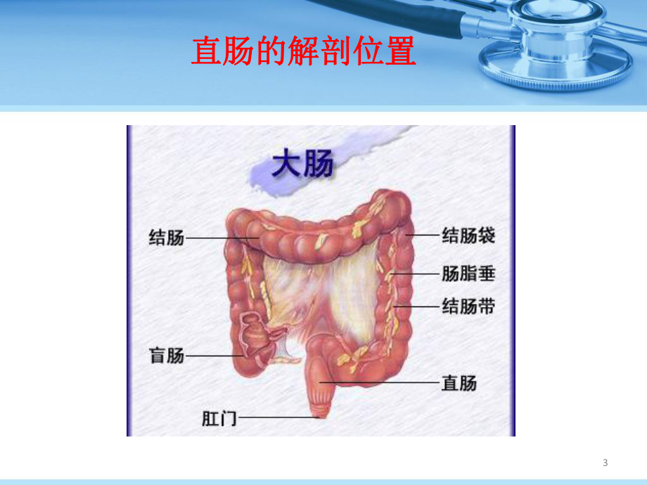 直肠癌护理业务学习课件.pptx_第3页