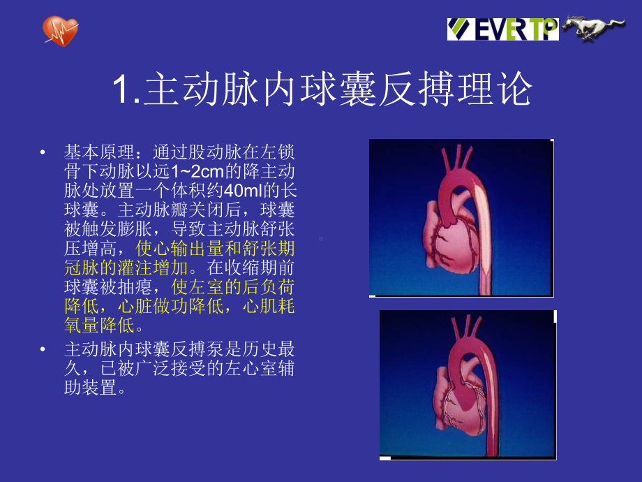 IABP的临床使用解析课件.ppt_第2页