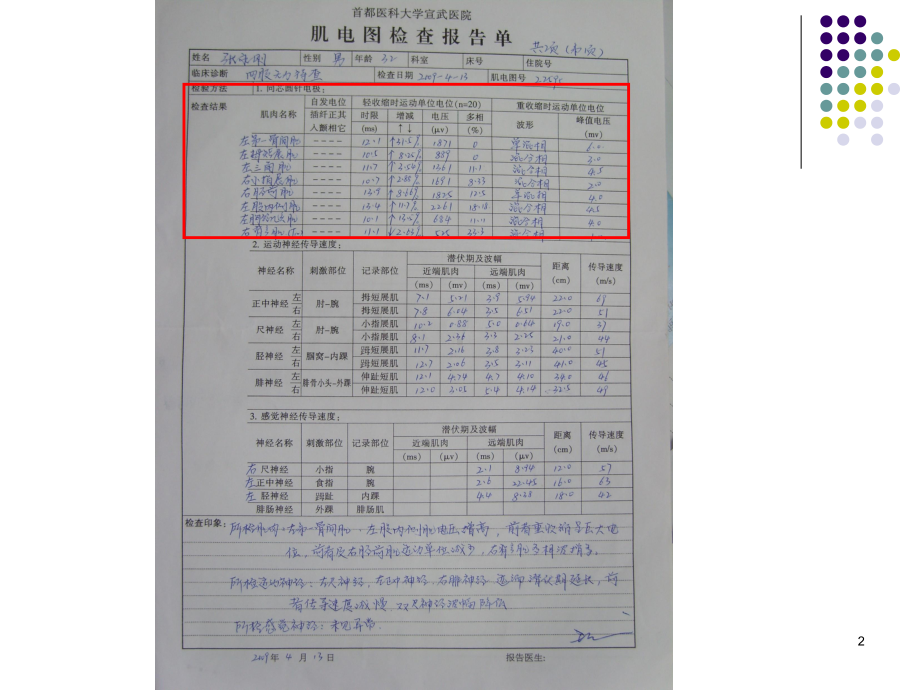 肌电图的判读医学课件.ppt_第2页