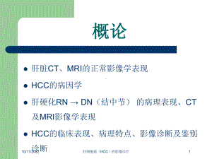 肝细胞癌(HCC)的影像诊疗培训课件.ppt