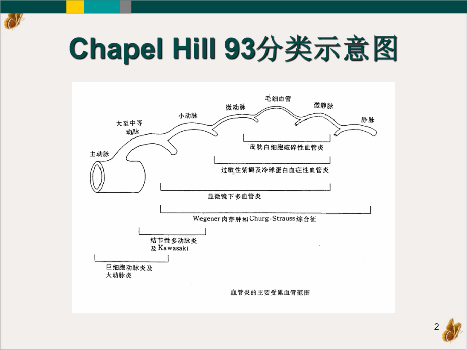 结节性多动脉炎课件1.pptx_第2页